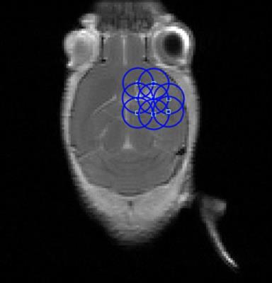 Towards standardization of the parameters for opening the blood–brain barrier with focused ultrasound to treat glioblastoma multiforme: A systematic review of the devices, animal models, and therapeutic compounds used in rodent tumor models